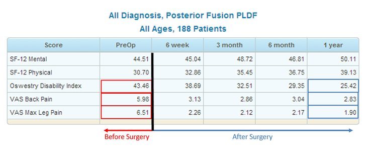 Spine Center Posterior Fusion Treatment Results
